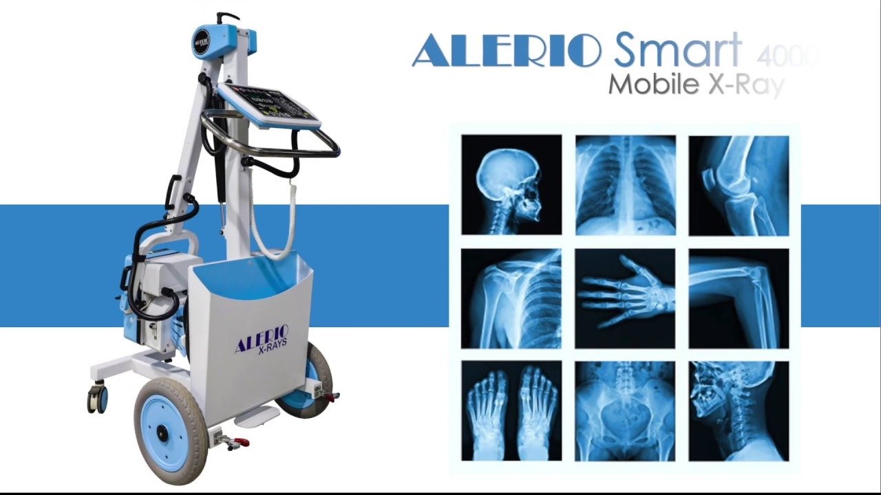 ALERIO Smart 4200 Mobile X-Ray Machine