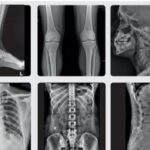 BPL MRAD 3.5 DR mobile x ray machine