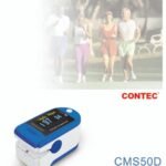 Contec Pulse Oximeter